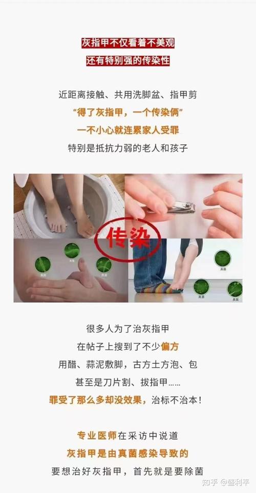 发霉一个传染俩,真不是开玩笑