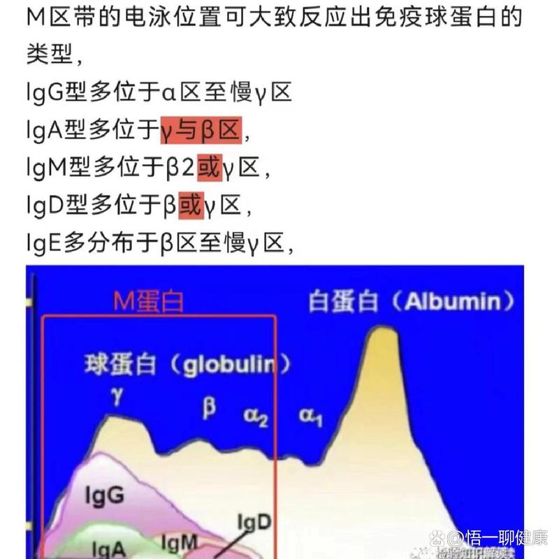 EBM扫描路径岛状分区示意图