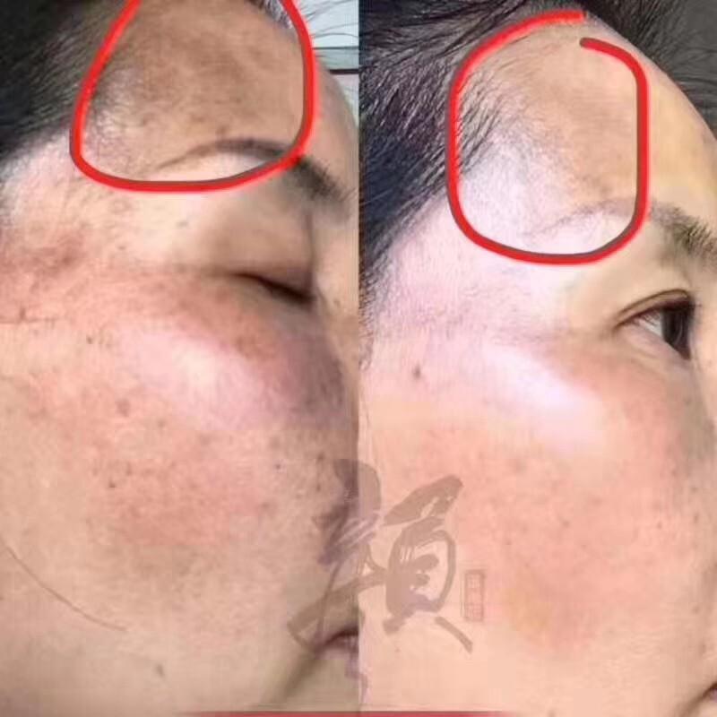 修完怎么验证，别留后遗症