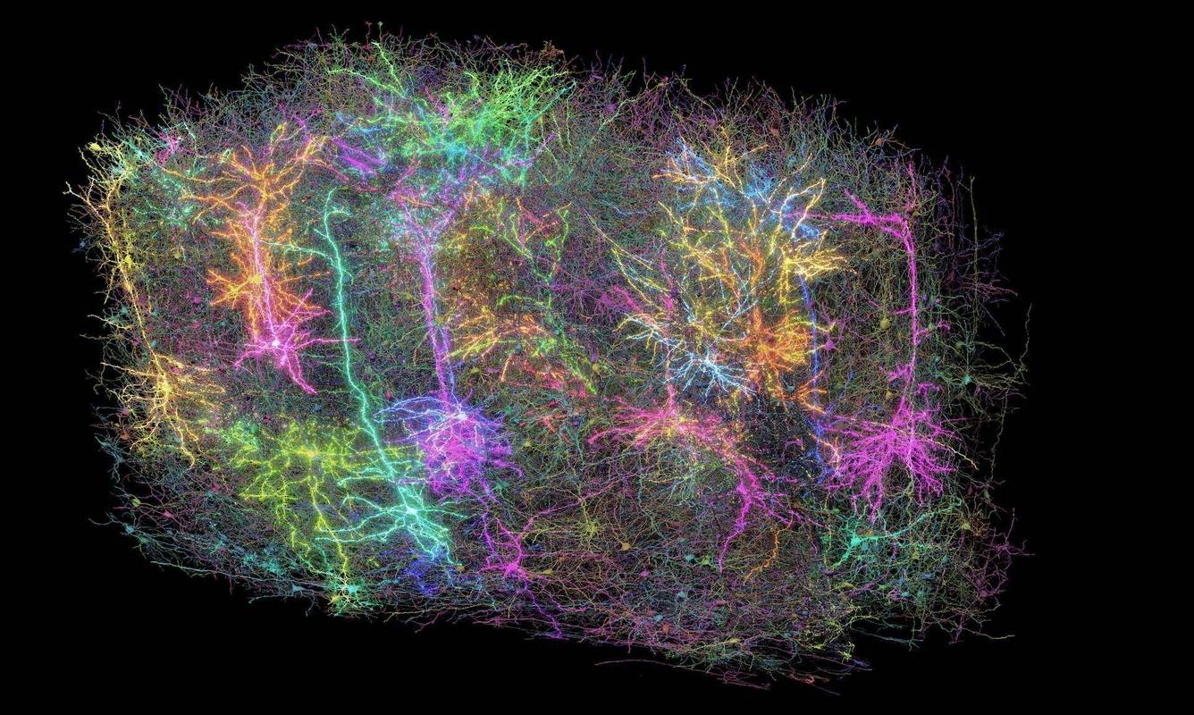 类脑芯片神经元阵列与生物脑神经元连接对比显微图