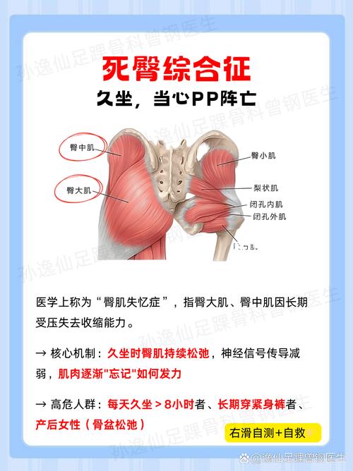久坐人群活动:别让屁股粘在椅子上-仁者医