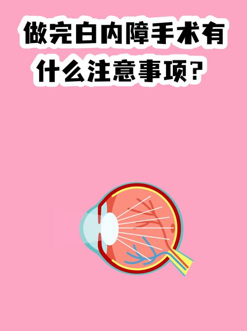 最后说几个需要注意的点