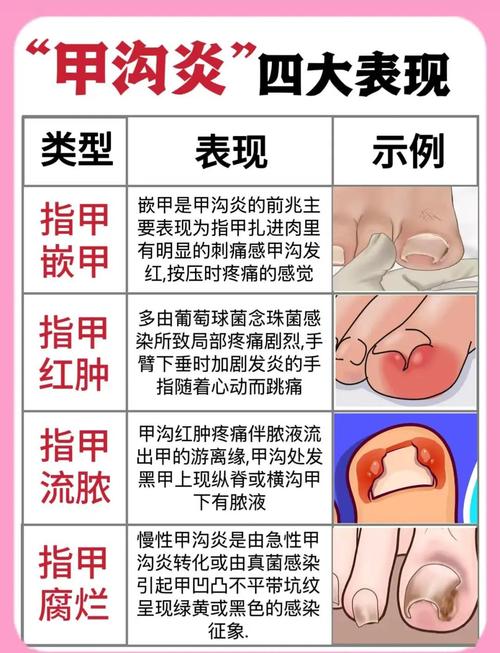 宝宝甲沟炎危险症状对比图