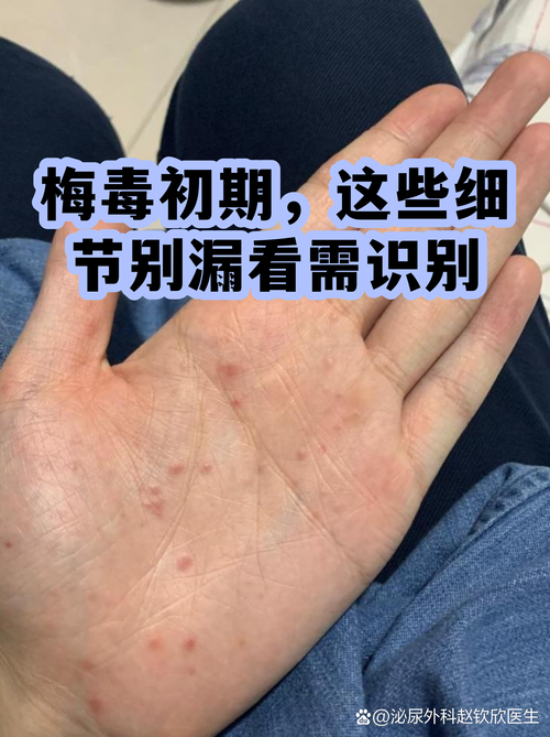 别忘了这些容易漏的小细节