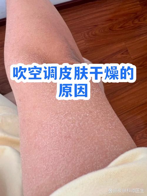 空调房干燥皮肤紧绷状态示意图