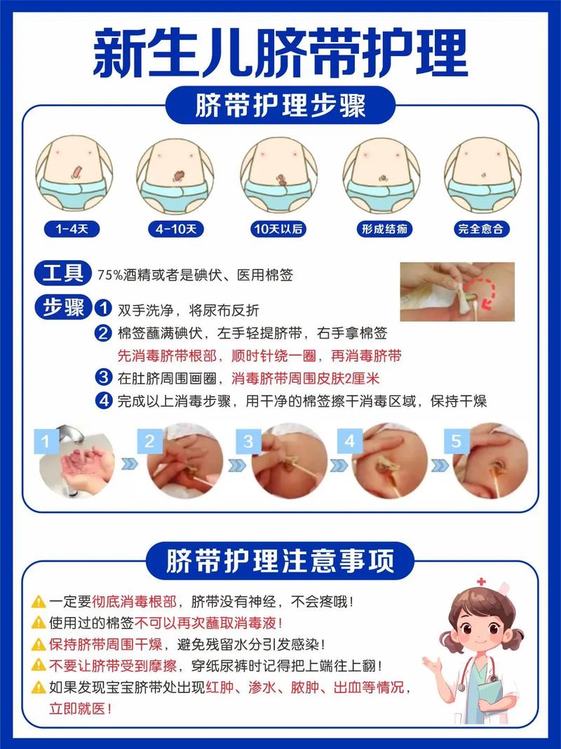 新生儿脐带自然干燥护理方法