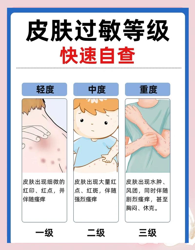 过敏史管理的三重境界,你到了哪层?