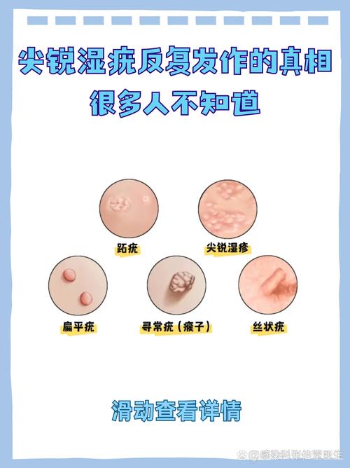 QA:读者最关心的几个尖锐问题