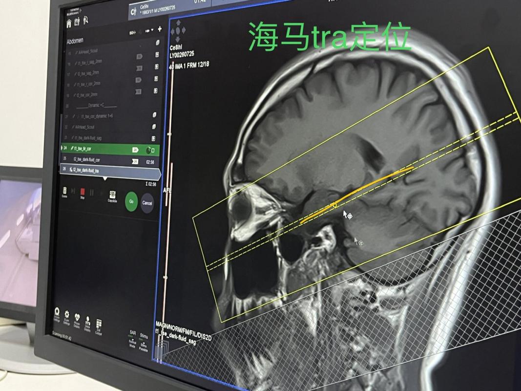 终身学习体系，你的大脑其实一直在等这一天