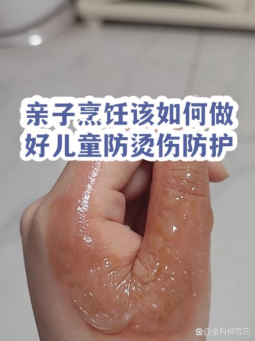 厨房儿童安全门栏防烫伤