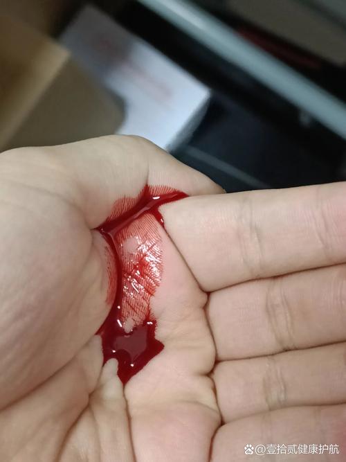 真剪出血了，别慌