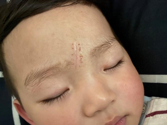 宝宝理发后的就医红线