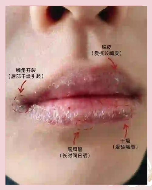你的嘴唇天生就比别的皮肤脆弱