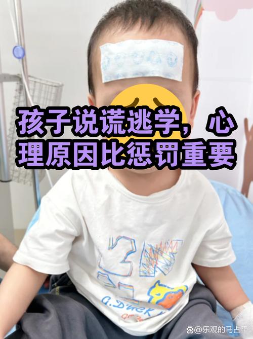 哪些四岁说谎必须找医生