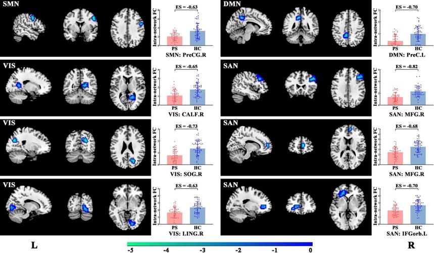 fMRI 脑信号解码自然语言过程图