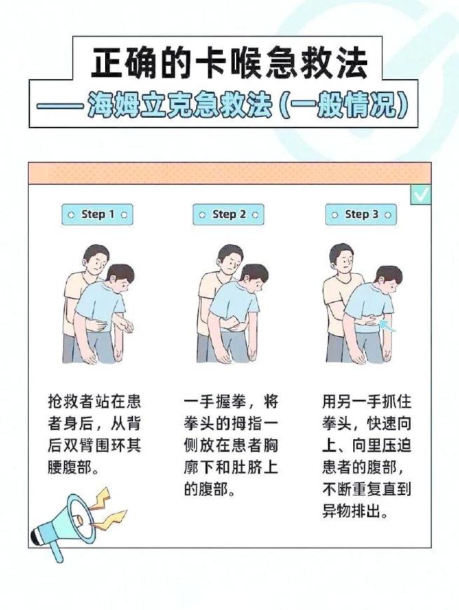 成人异物呛咳应对站位示意图