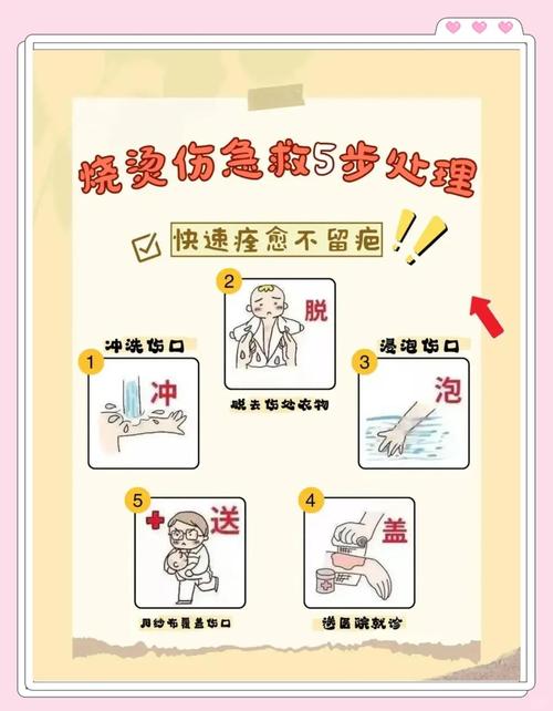怎么判断宝宝烧烫伤要不要送医院？