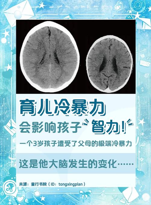 为什么娃一到两岁就翻脸?大脑里的战争