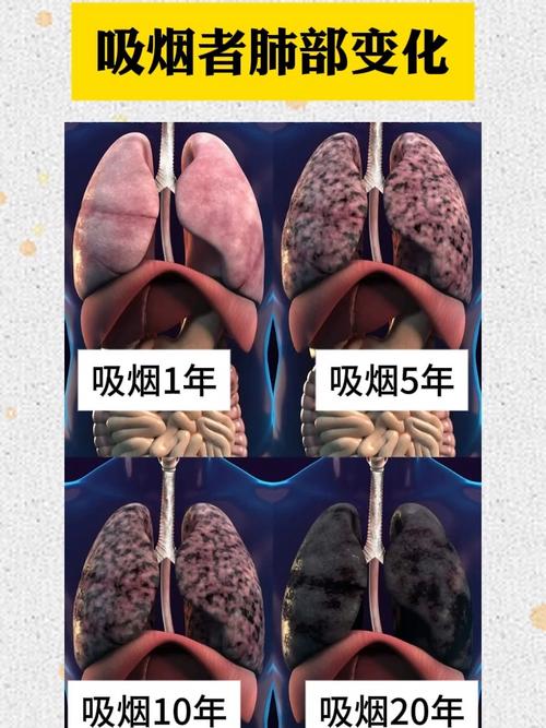 吸烟人群肺功能下降早期信号对照表