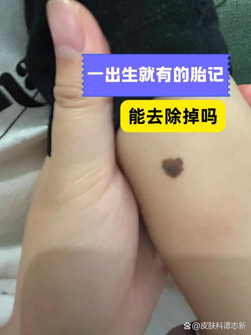 你家里的塑料，生来就带着“胎记”