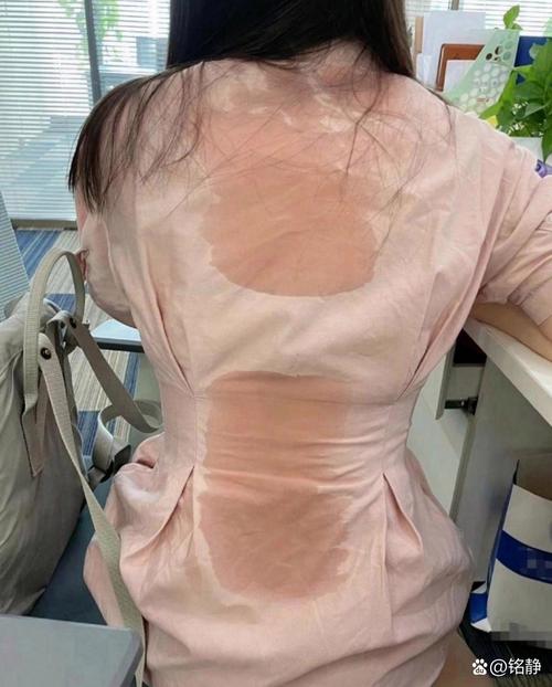 夏天出汗后后背衣服盐渍实拍图