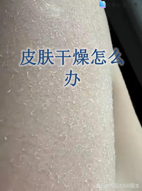 现场QA：你一定会碰到的干燥难题