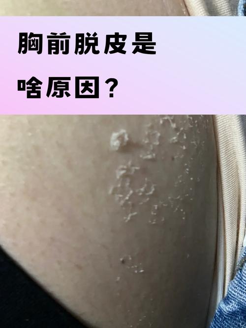 离个婚，脱层皮