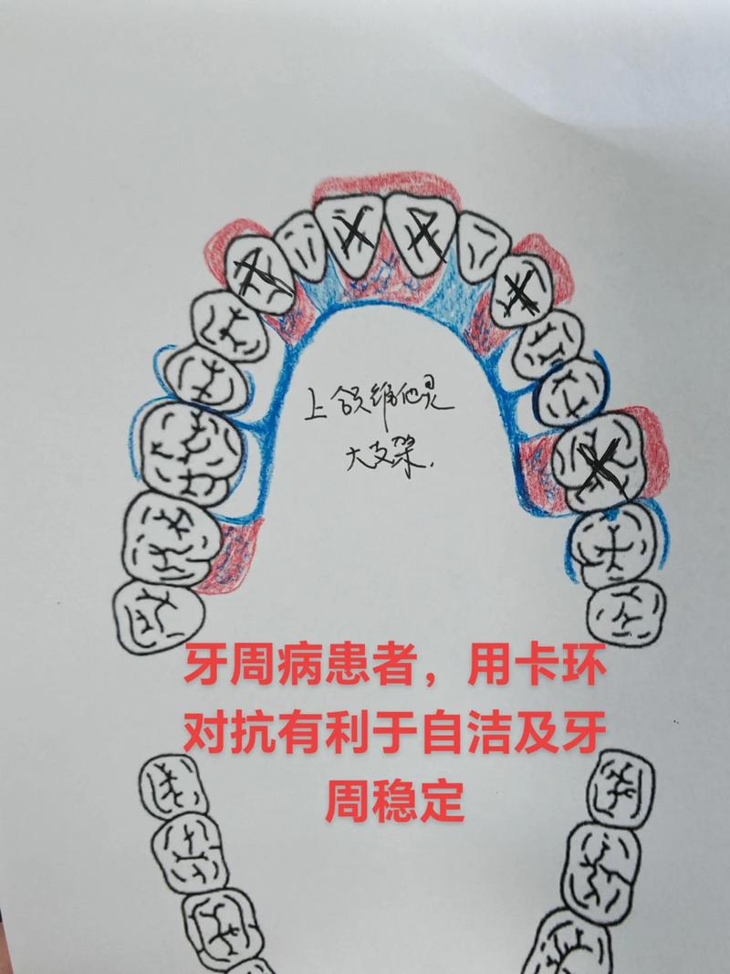 别只会看材质,齿型设计才是灵魂