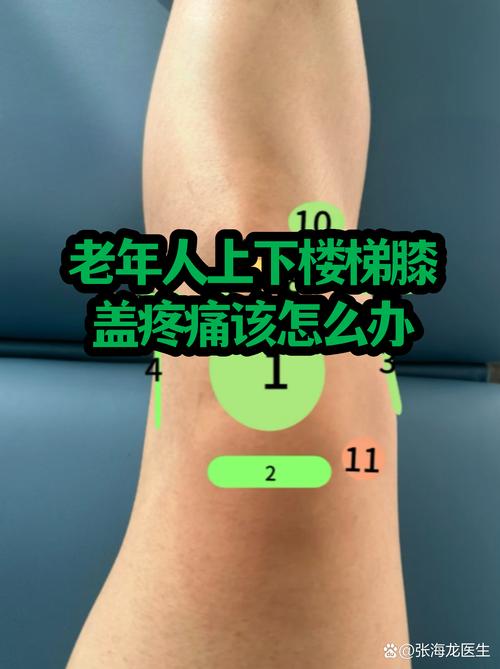 膝关节骨关节炎上下楼受力示意图
