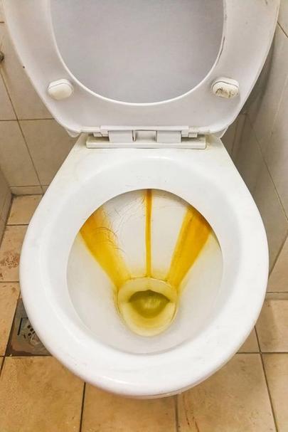 米白色智能马桶边缘黄垢实拍