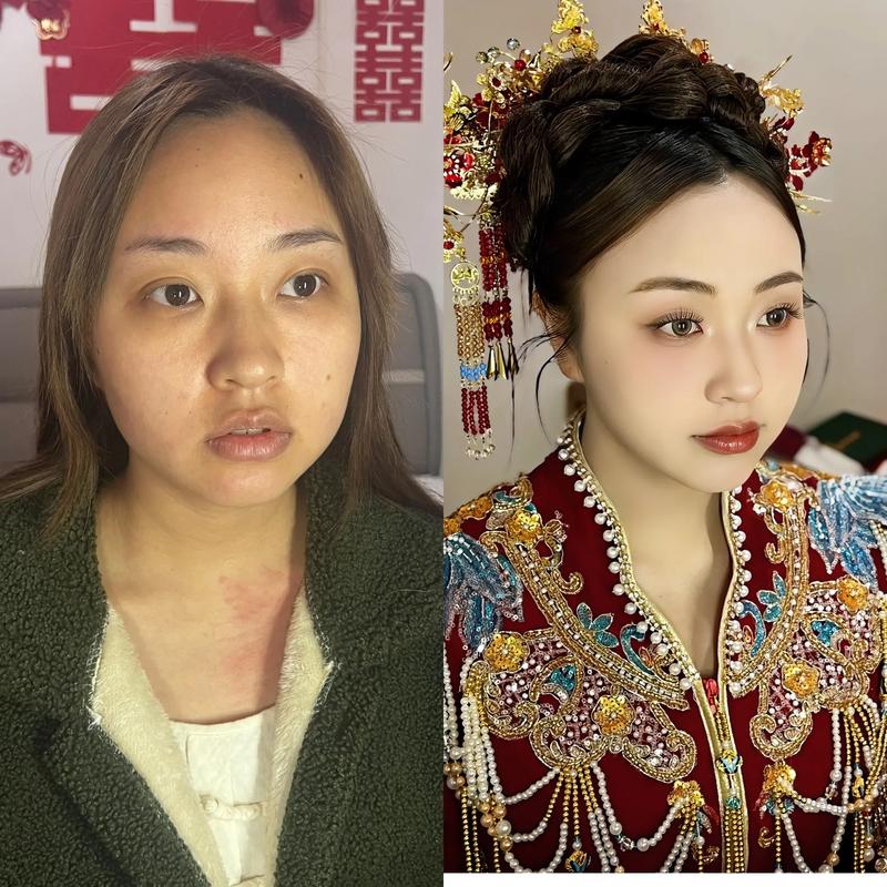 新娘虎牙被不当修掉精修对比