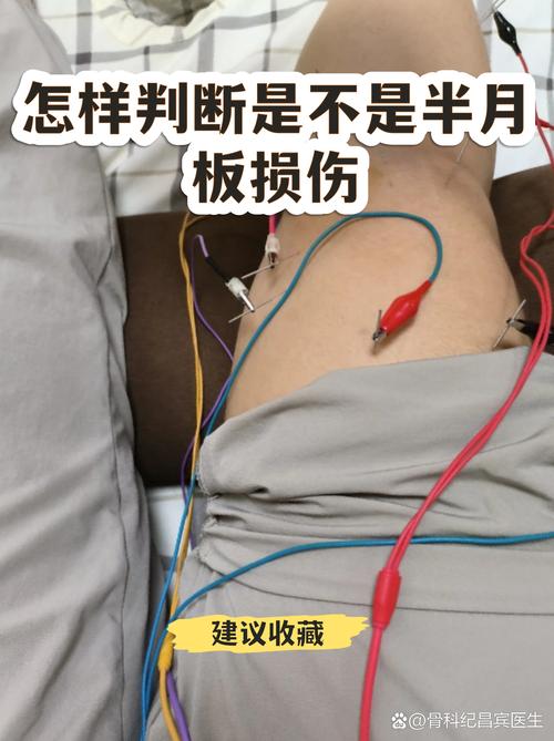 在家就能做的初步判断，别等瘸狠了再去医院