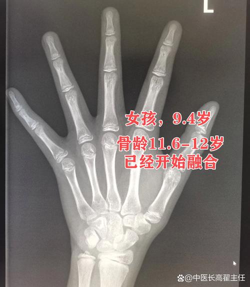 从门后身高线分辨要不要就医的红线