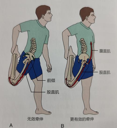适合拉伸的常见僵硬关节示意图