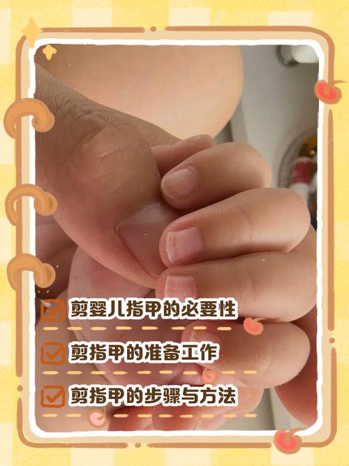 划好红线！宝宝指甲修剪后这些情况必须就医