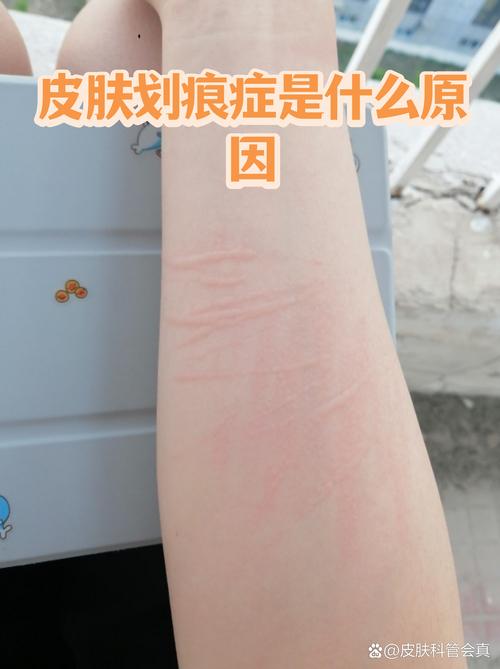 恐怖的划痕与意外:怎么救?多少钱?