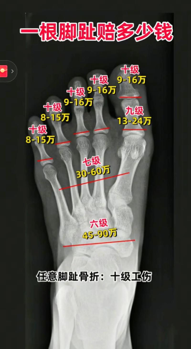 脚位不对，后面全白费