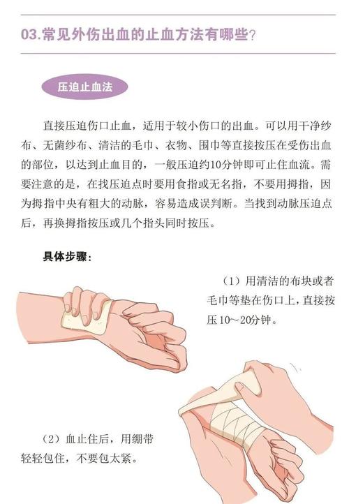 工业外伤出血压迫止血操作示意图