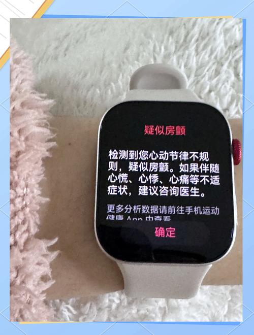 智能手表房颤检测提醒界面