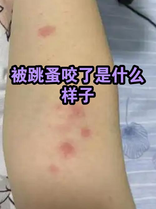藏在小虫子身上的，是被我们弄丢的慢节奏