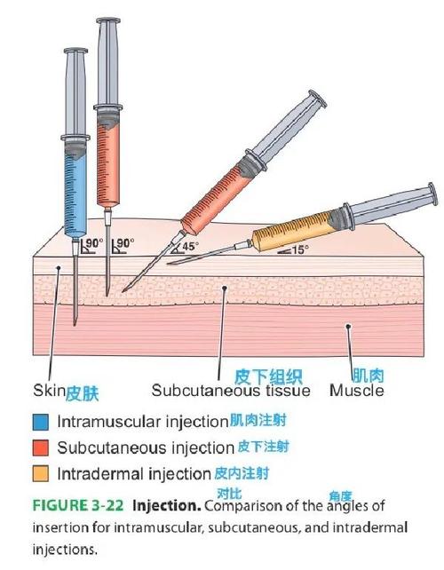 针尖与手指皮肤压强对比示意图
