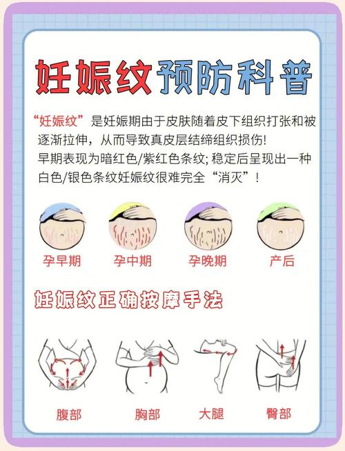 妊娠纹:预防比修复重要一万倍