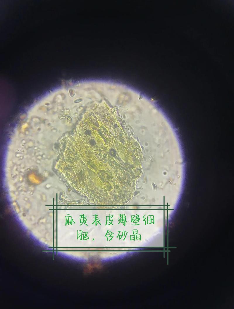 沙粒：我们踩在脚下的，是山海的遗言-因为所以