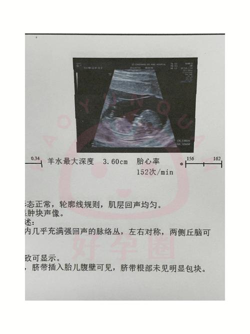 胎儿超声产检报告单照片