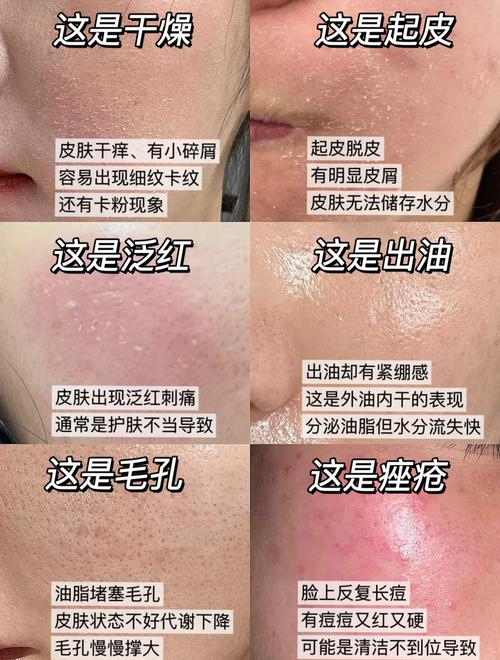 真空干燥到底好在哪？先撕掉那些营销面具