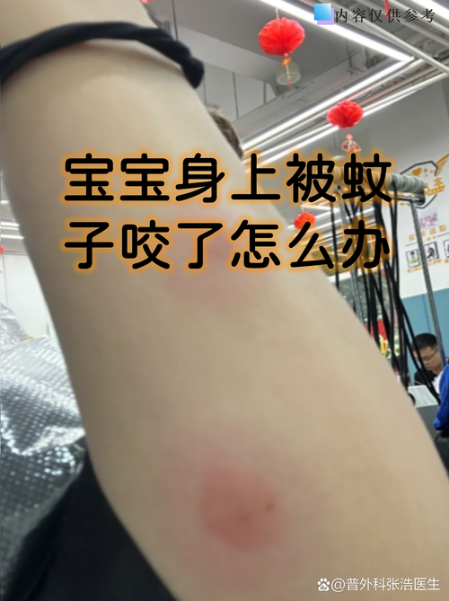 2岁宝宝情绪激动咬家长手臂的抓拍场景