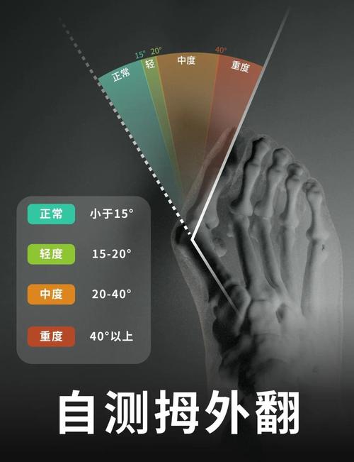 修好外倾的硬标准，这些数据错一点都不行