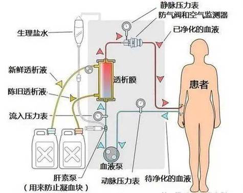 透析机碳酸氢盐透析液脱气模块管路连接图