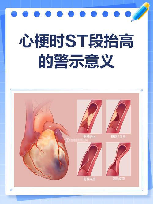 E:抬高,得高过心脏才有用
