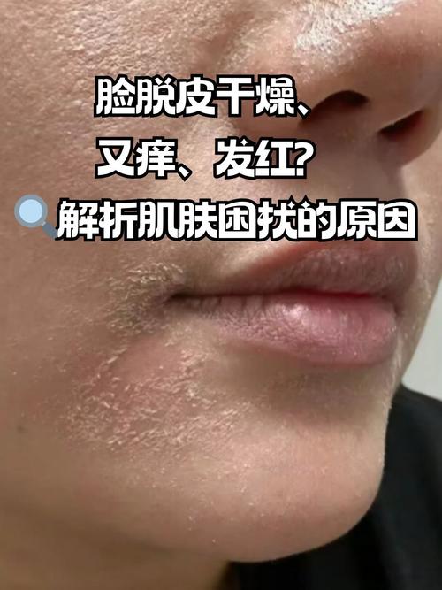 别光顾着脸，身上的皮肤也是皮肤啊